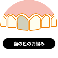 歯の色のお悩み