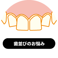 歯並びのお悩み