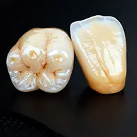 セミックインレー