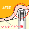 サイナスリフト