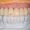 プロビジョナル