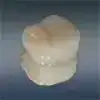 セラミックアンレー