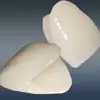 EMAXセラミッククラウン