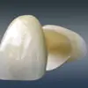 オールセラミックジルコニアクラウン