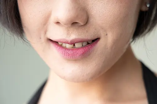 すきっ歯を強調した女性