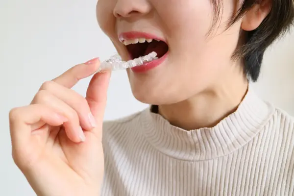 マウスピース矯正の取り外し