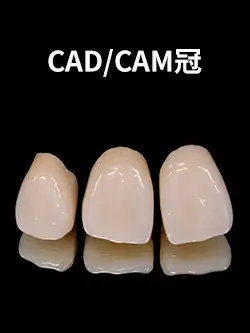 CAD／CAM冠