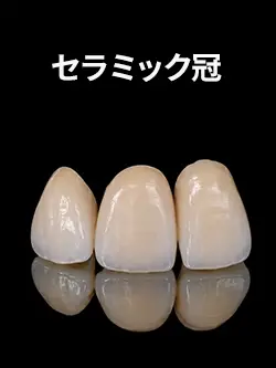 セラミック冠