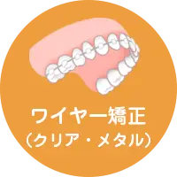 ワイヤー矯正
