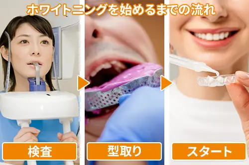 通常のホワイトニングの順序