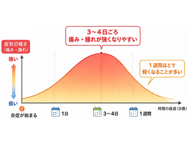 親知らずの歯ぐきの腫れが落ち着くまでの目安